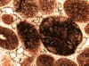 Figure 5. Completely micritized ooids in the Black River Formation.